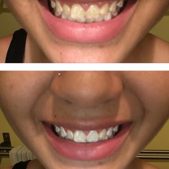 Nuskin Whitning toothpaste - Picture 3 of 4